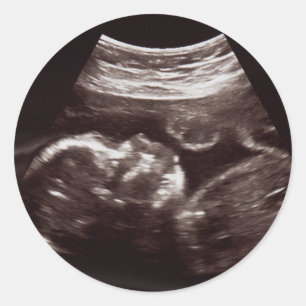 Ultrasound Foto Baby shower Dank u zegel