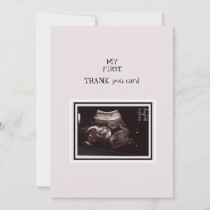 Ultrasound Foto roze Hartelijk dank Baby Bedankkaart
