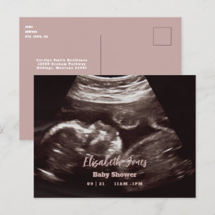 Ultrasound Fotoroze Baby shower Aankondigingskaart