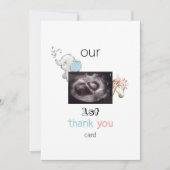 Ultrasound Funny Twin 1er Carte de remerciements B (Devant)