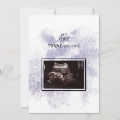 Ultrasound Girl Merci Baby Point de vue (Devant)