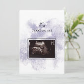 Ultrasound Girl Merci Baby Point de vue (Debout devant)