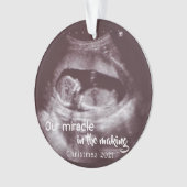 Ultrasound Miracle In Making 2 Photo Baby Annonce (devant)