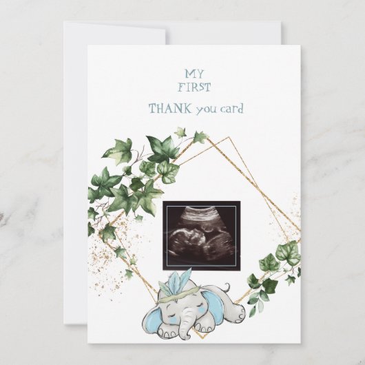 Ultrasound Photo Boy Merci Baby Point de vue (Devant)