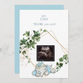 Ultrasound Photo Boy Merci Baby Point de vue (Devant / Derrière)