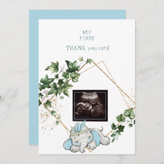 Ultrasound Photo Boy Merci Baby Point de vue (Devant / Derrière)