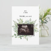 Ultrasound Photo Merci neutre Baby Viewpoint (Debout devant)