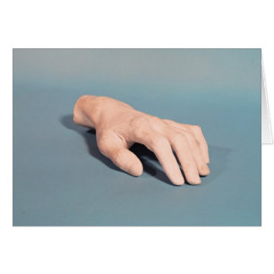 Un moulage de la main de Frédéric Chopin