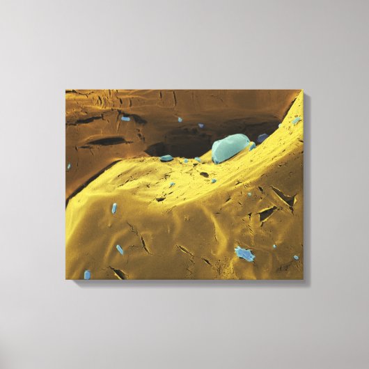 Ureumpoeder Canvas Afdruk (Voorkant)