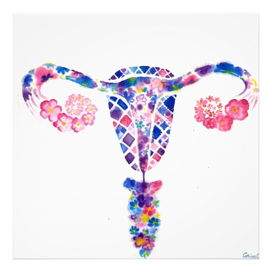 Uterus Foto Afdruk (Voorkant)