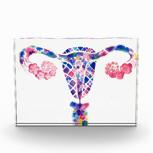 Uterus Fotoblokken (Voorkant)