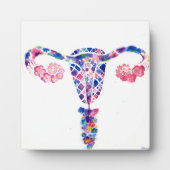 Uterus Fotoplaat (Voorkant)