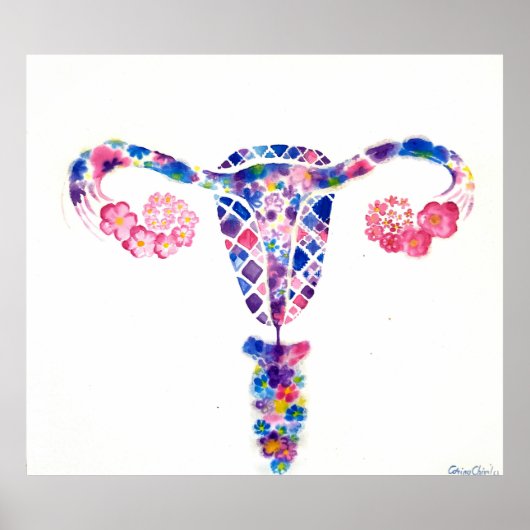 Uterus Poster (Voorkant)