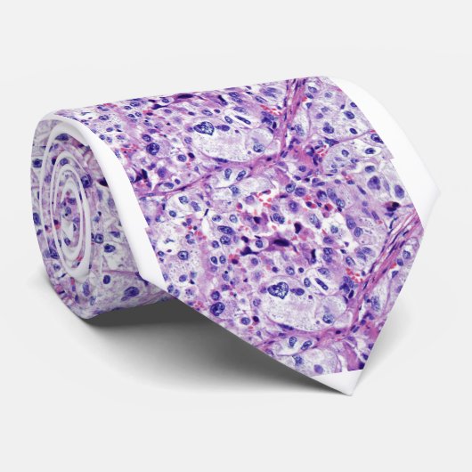 Valentijn Pleomorphic Sarcoma Stropdas (Opgerold)