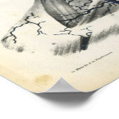 Veinen van hoofd-nekanatomie afdrukken poster (Hoek)