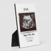 Veldendag script Ultrasound Foto Zwangerschap Pap Fotoplaat (Zijkant)