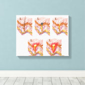 Verschillende soorten Acne Canvas Afdruk (Insitu (Houten vloer))