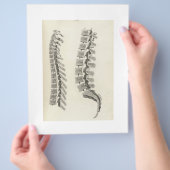 Vertebrae tekening flyer (Hand)