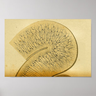Vintage 1886 Central Nervous System Nerves Poster