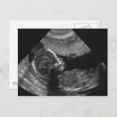 visage de bébé, carte (Devant / Derrière)