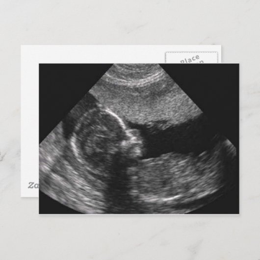 visage de bébé, carte (Devant / Derrière)