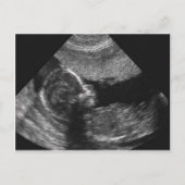 visage de bébé, carte (Devant)