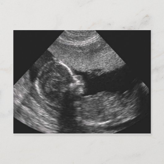 visage de bébé, carte (Devant)