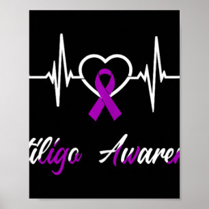 Vitiligo Bewustzijn Hartslag Liefde Paarse Ribbon  Poster