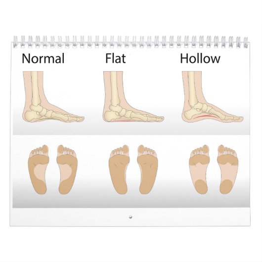 Voetmisvormingstypen Kalender (Hoes)