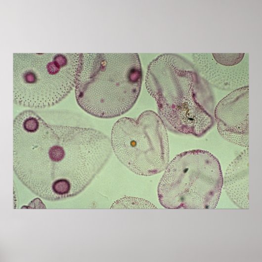 Volvox, algen poster (Voorkant)