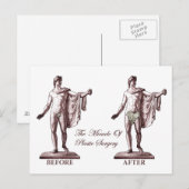 Vóór en na briefkaart (Voorkant / Achterkant)