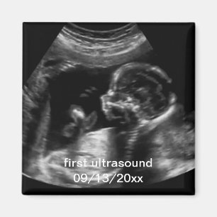 Voor nieuwe moeder: Ultrasound Sonogram Baby Magneet