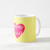 Vous êtes adoré Mug Jaune (Devant droit)