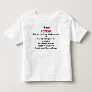 Vragen over de brandende wonden van Eczema, beantw Kinder Shirts