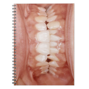 Weird Unusual Gory Teeth Gums Foto Notitieboek