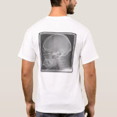 Weird X-Ray T-shirt (Achterkant)