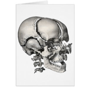  Wetenschap Menselijke Anatomie, Antiek schedel