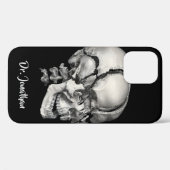 Wetenschap Menselijke Anatomie, Antiek schedel Case-Mate iPhone Case (Achterkant (horizontaal))