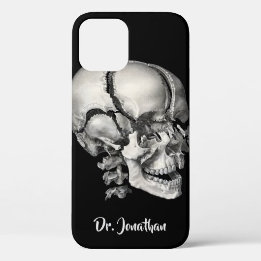 Wetenschap Menselijke Anatomie, Antiek schedel Case-Mate iPhone Case (Achterkant)