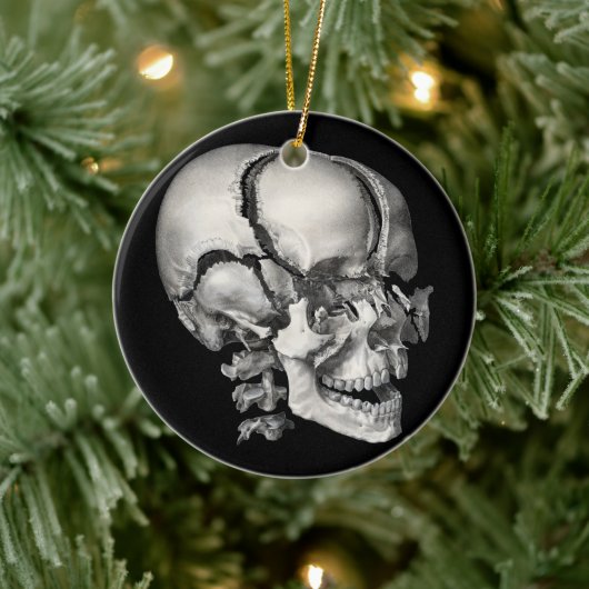  Wetenschap Menselijke Anatomie, Antiek schedel Keramisch Ornament (Boom)