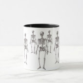 Wie heeft het Skelet uit de Kast gezet? Mok (Midden)