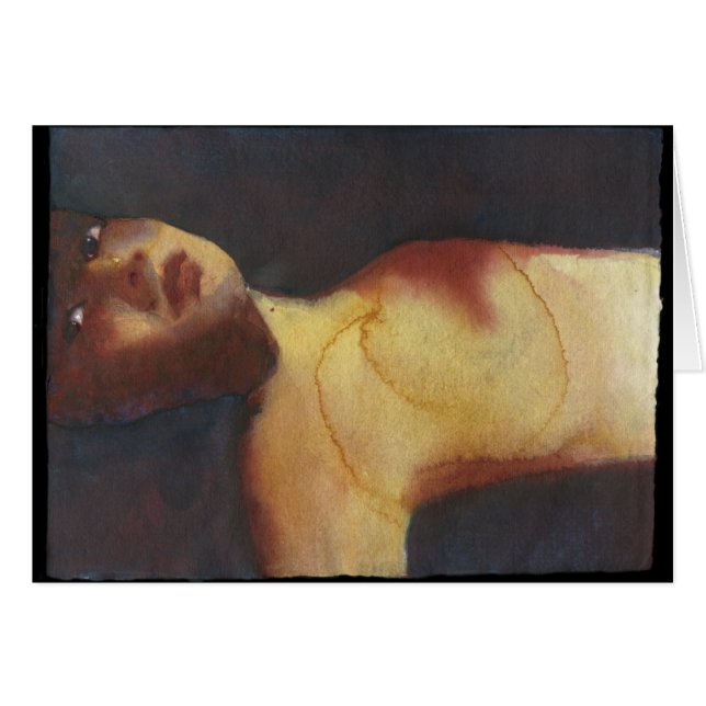 Wond (Voorkant Horizontaal)