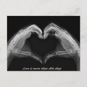X-Ray Art Briefkaart