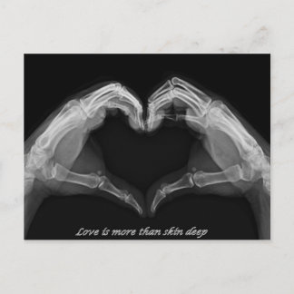 X-Ray Art Briefkaart