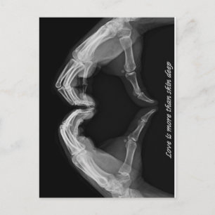 X-Ray Art Briefkaart