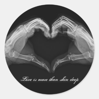 X-Ray Art Ronde Sticker