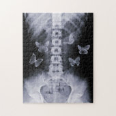 X-Ray Conceptual Butterflies Puzzle Legpuzzel (Verticaal)