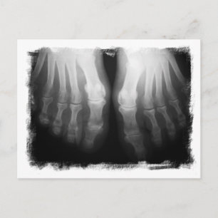 X-Ray Feet Human Skeleton Botten zwart-wit Briefkaart