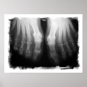 X-Ray Feet Human Skeleton Botten zwart-wit Poster