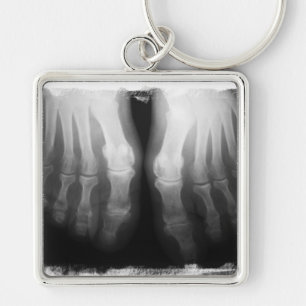 X-Ray Feet Human Skeleton Botten zwart-wit Sleutelhanger